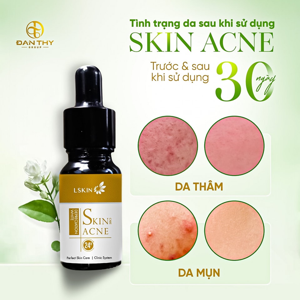 Cốt mụn Bạch Sen Lskin Đan Thy